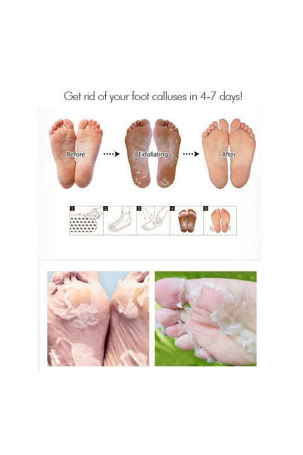 Mucizevi Peeling Ayak Maskesi Ölü Deri Soyan Çorap Peeling Maskesi - 3