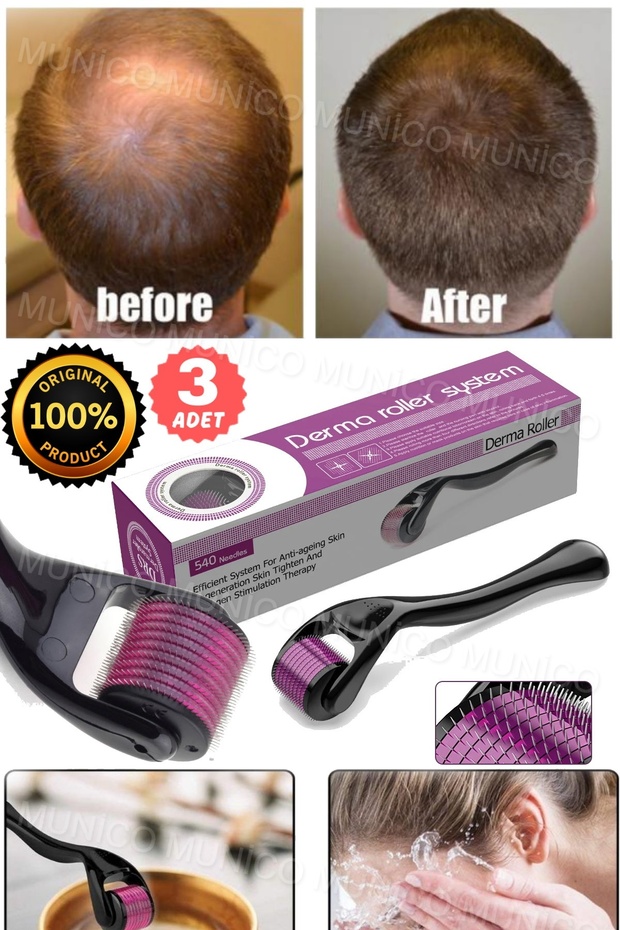 3 Adet Titanyum Mikroiğne Skar Derma Rulo Sakal Çıkma Saç Dökülmesi 1.0 mm Unisex İğneli Aparat Rulo - 7