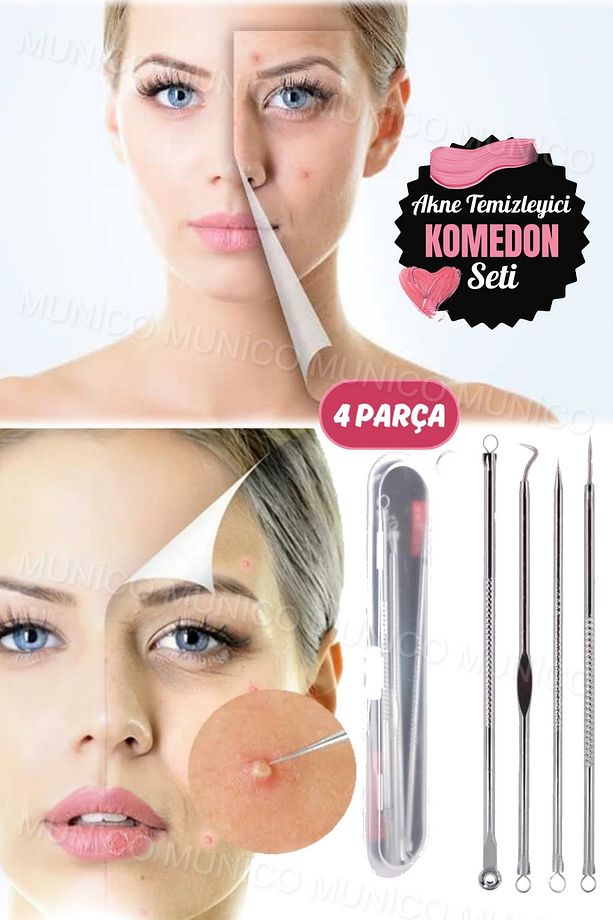 Siyah Nokta Temizleyici Set Sivilce Siyah Nokta Temizleme Kalite 4 Parça Paslanmaz Çelik Batık Ayak - 9