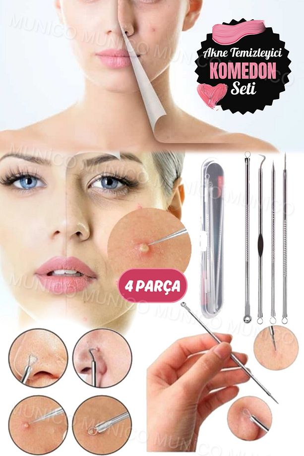 Siyah Nokta Temizleyici Set Sivilce Siyah Nokta Temizleme Kalite 4 Parça Paslanmaz Çelik Batık Ayak - 4