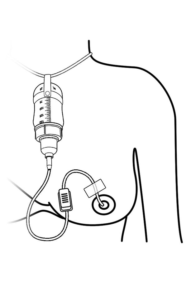 Emzirme Destek Sistemi Eds 150ml -ayd150 - 3