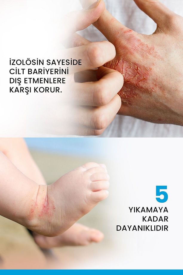 Dexyane Barrier Kuru Ciltler Için Nemlendirici Krem 100 ml - 3