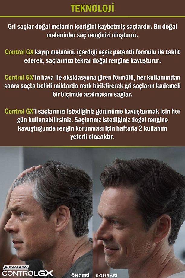 Control GX Saç Gri Azaltıcı Şampuan 3'lü Set - 4