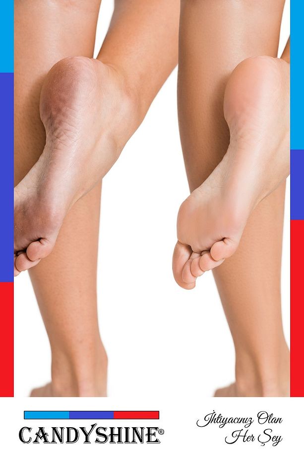 ® Pratik Ergonomik Ayak Topuk Törpüsü Rendesi Ölü Deri Ve Nasır Temizleyici Rötuş Zımparalı - 4