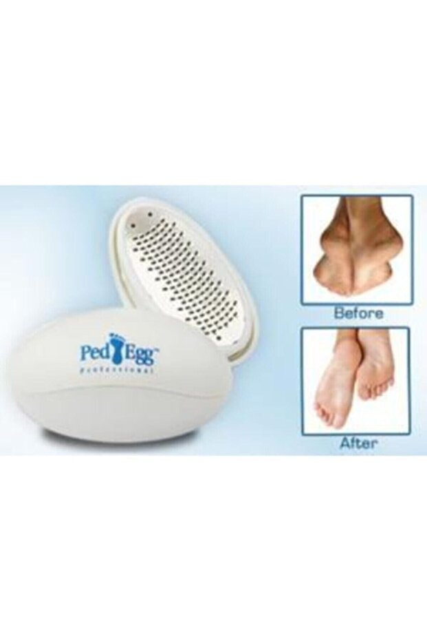 SVRM Ayak Rendesi Topuk Nasır Temizleme Ayak Bakım Törpüsü - 1