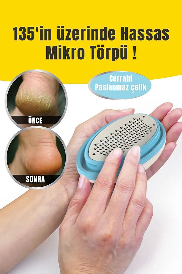 Topuk Nasır Temizleme Bakımı Ayak Bakım Törpüsü Kutulu Ayak Rendesi - 6