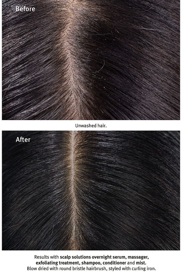 Scalp Solutions Saç Derisi Için Şampuan 50ml 018084040553 - 6