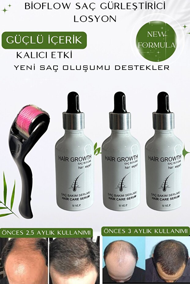 Bioflow Hair Hair Strengthening Lotion / Solution for Hair Loss from the Root / 3 Dermarollers