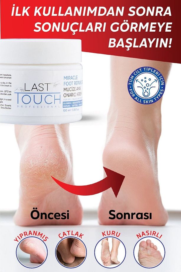 Çatlak Onarıcı Mucize Ayak Bakım Kremi 100 ml ( Vazelin & Shea Butter ) - 4
