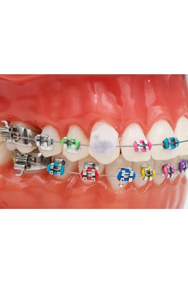 شمعة الأسنان 2 عبوة - 5