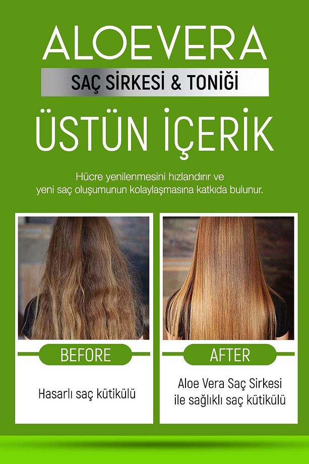 Aloe Vera Özlü Saç Sirkesi & Saç Toniği 400 Ml - Kepek Ve Dökülme Karşıtı - Hızlı Uzama Etkili - 6