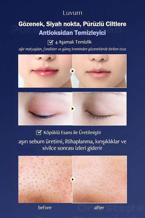Siyah Nokta Ve Gözenek Temizleme Pedi Pore Deep Cleansing Pad 1 Adet - 5