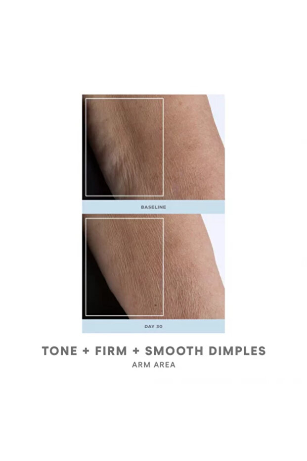 جهاز شد البشرة من نوبودي - 5