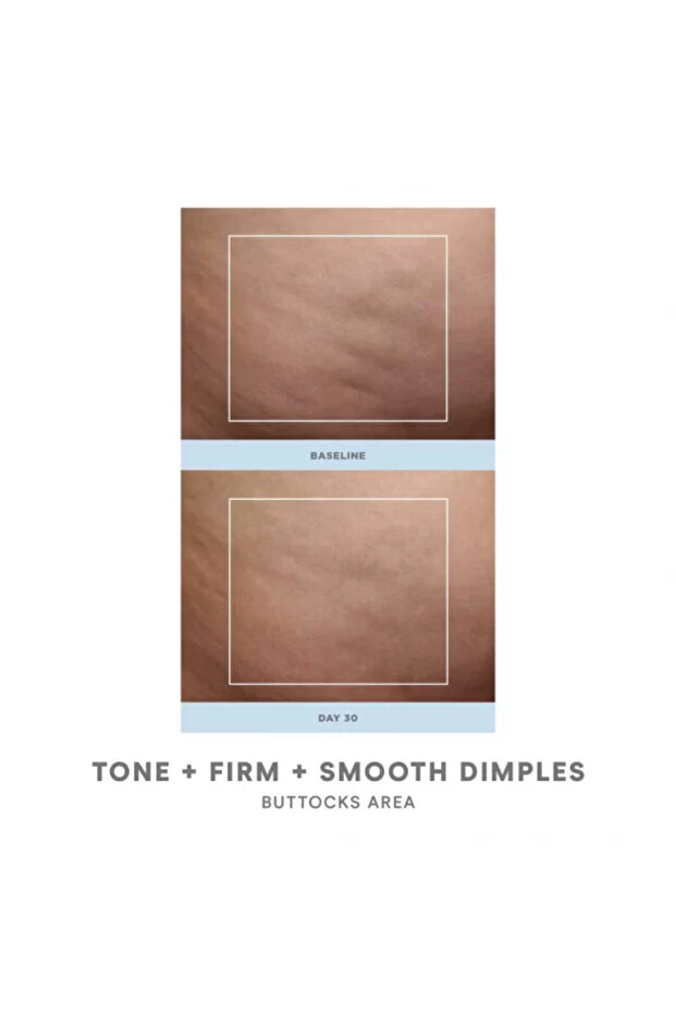 جهاز شد البشرة من نوبودي - 4