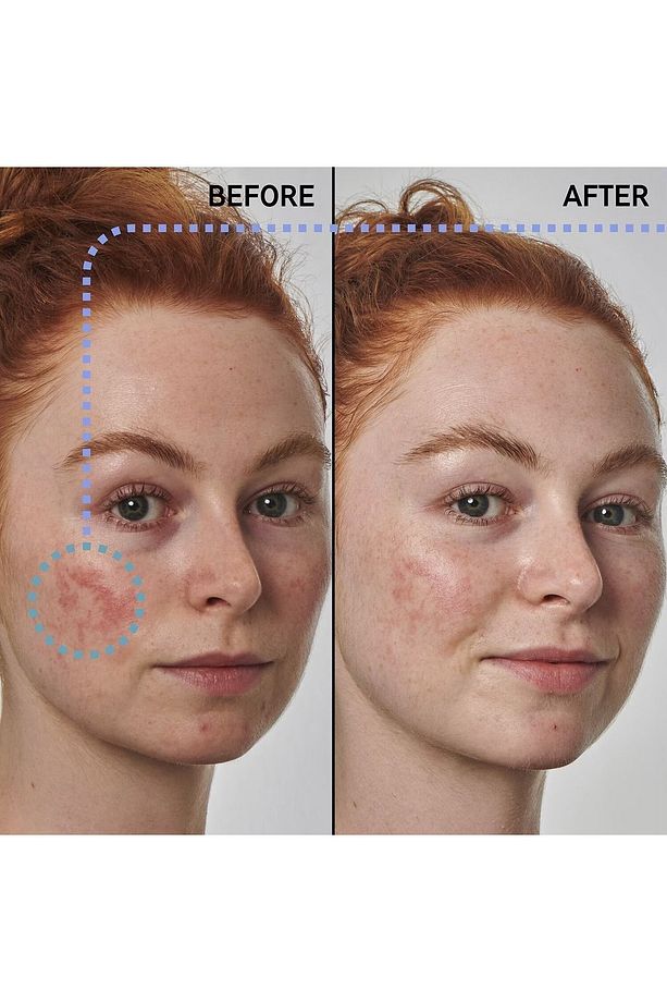 Redness Solution with 10% Azelaic - Yüz Serumu - 30 ml - 2
