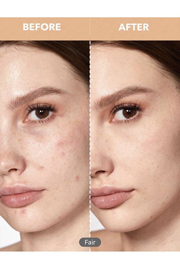- Concealer- Chantillv - 3