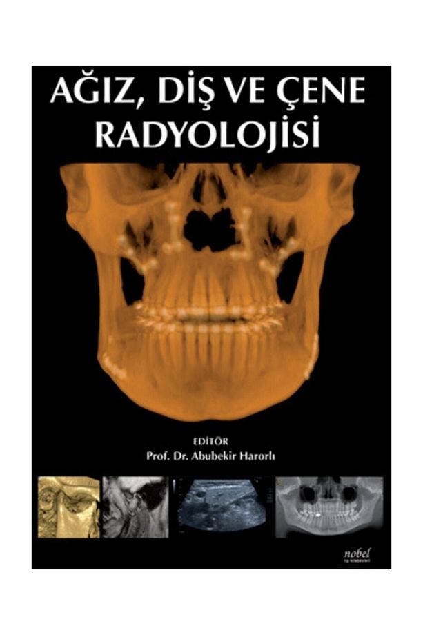 Ağız Diş Ve Çene Radyolojisi - 1