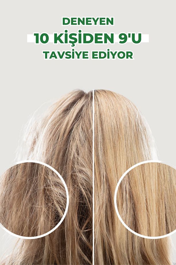 Extra Plus Sarımsaklı Şampuan Yoğun Saç Dökülmesine Karşı Şampuan 450ml Beta Karoten Ve Çinko Içerir - 6
