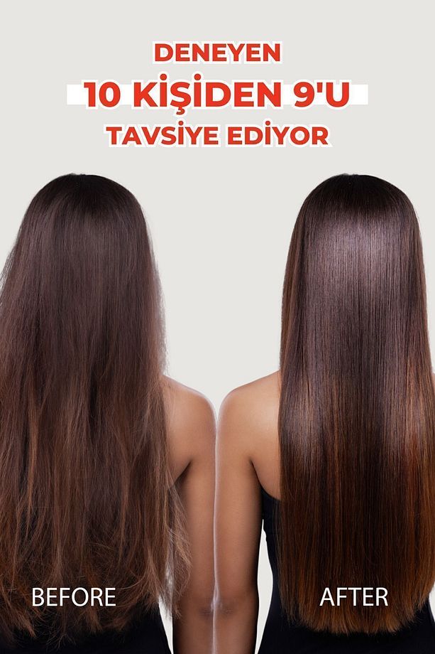 Forte Kuru Ve Normal Saçlar Için Saç Dökülmesine Karşı Şampuan 300 ml 3 Al 2 Öde Biotin Keratin - 7