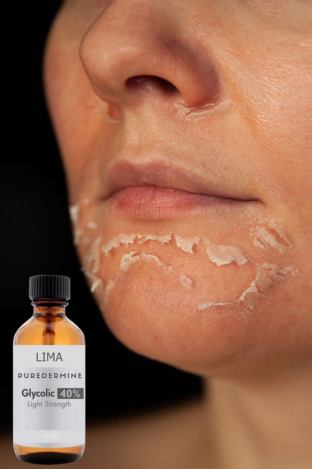 Lima Kimyasal Peeling & Saf Glikolik Asit & % 40 Glikolik Asit & Cilt Soyma & Cilt Yenileme - 1