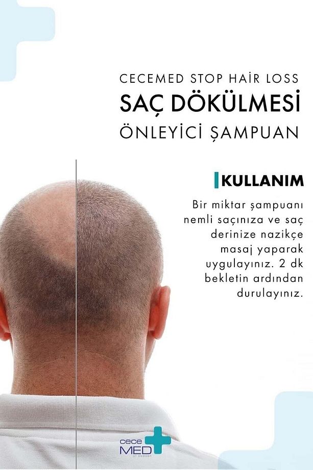 Saç Dökülmesi Önleyici Şampuan 300 Ml - 3