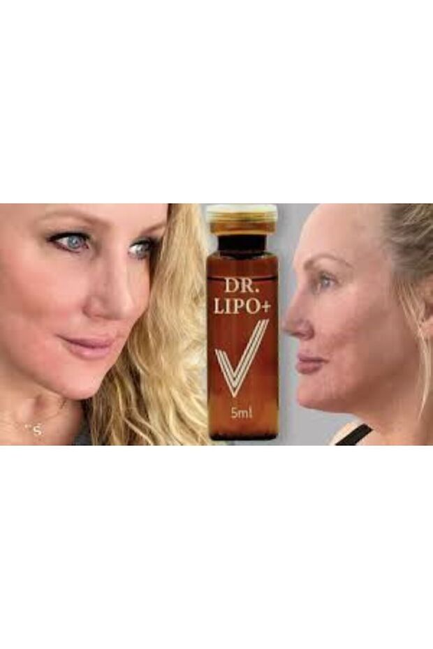 Lipo Mezoterapi Gıdı Eritme, Yanak Inceltme [1 Flakon 5ml Fiyatıdır] - 3