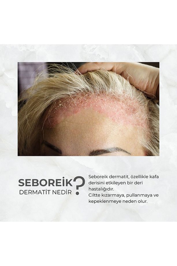 Tea Tree Shampoo Çay Ağacı Özü Içeren Şampuan 350 Ml - 5