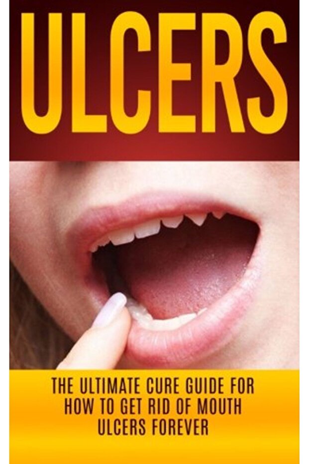 Ulcers The Ultimate Cure Guide For How To Get Rid Of Mouth Ulcers Instantly