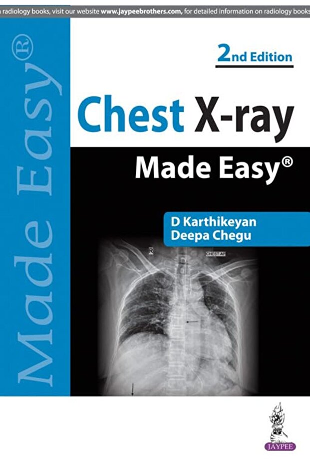 Chest Xray Made Easy