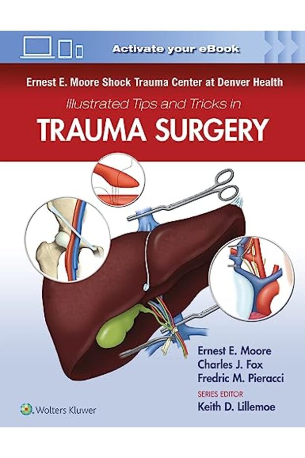 Ernest E Moore Shock Trauma Center At Denver Health Illustrated Tips And Tricks In Trauma Surgery