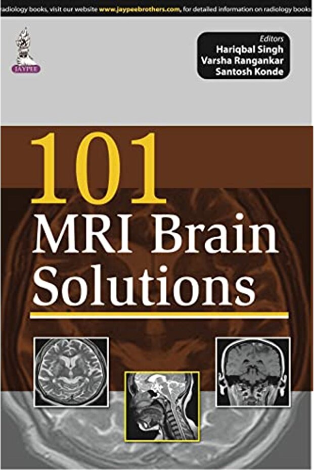 101 Mri Brain Solutions - 1