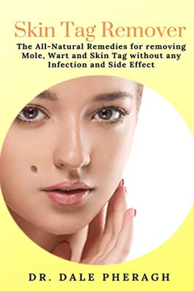 Skin Tag Remover The Allnatural Remedies For Removing Mole Wart And Skin Tag Without Any Infectio