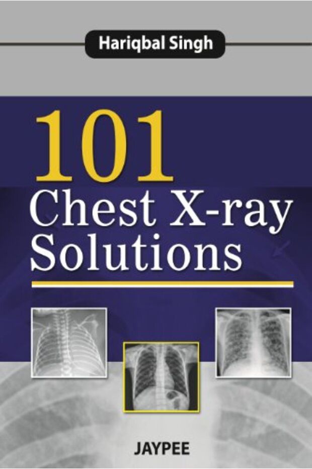 101 Chest Xray Solutions