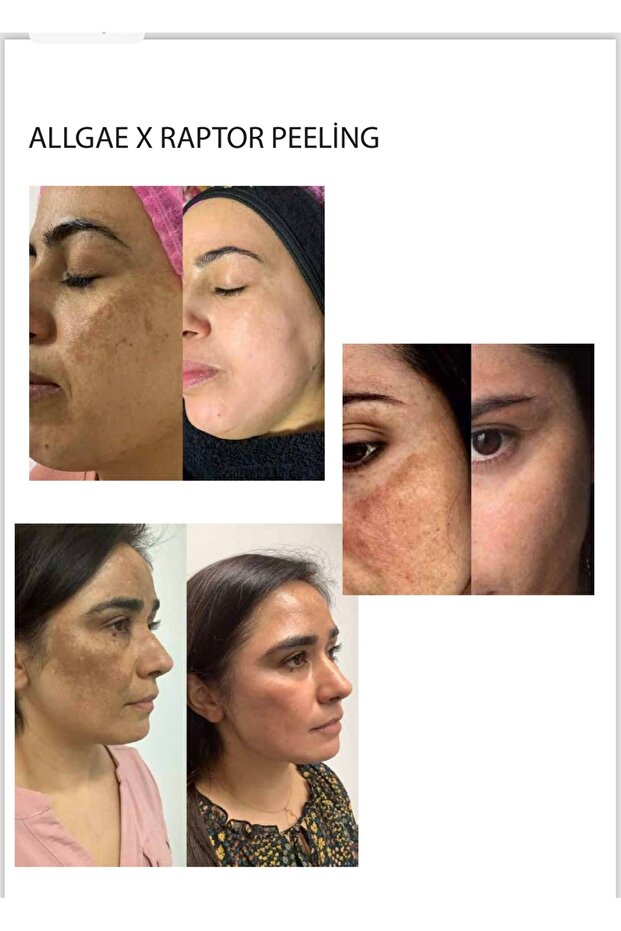 Peeling Algea Raptor - 2