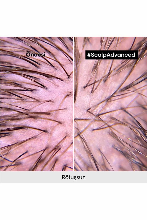 Serie Expert Scalp Advanced Hassas Saç Derisi Için Profesyonel Şampuan 500ml - 8
