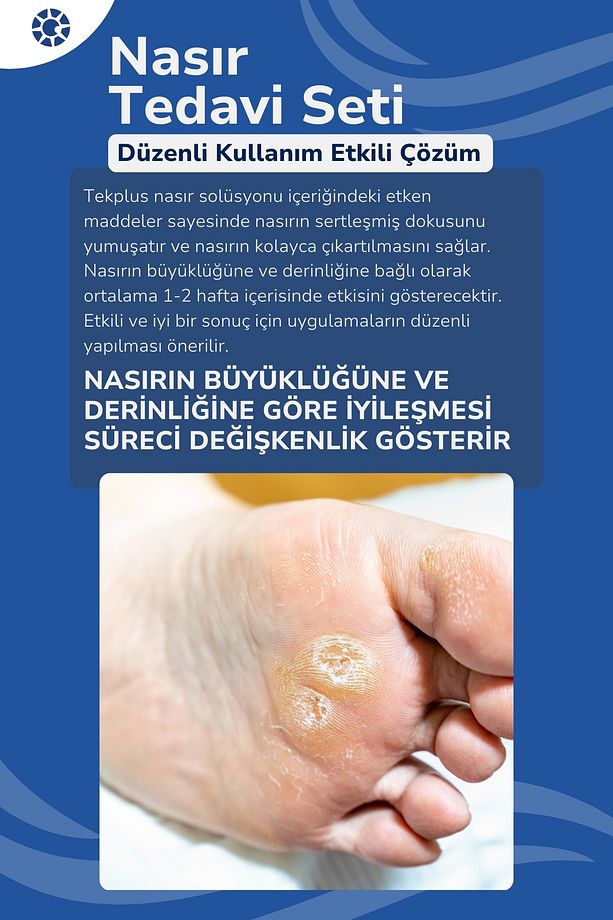 Nasır Tedavi Seti, Nasır Sökücü, Nasır Solüsyonu, Nasır Tedavi Seti, Nasır Giderici - 4