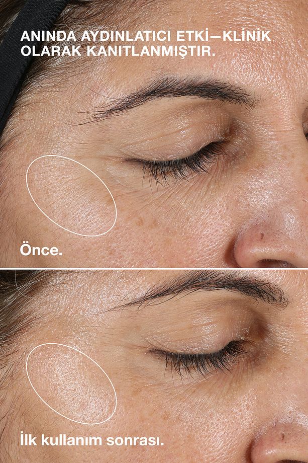 Clarifying Lotion (Tip 2) Kuru / Karma Ciltler İçin Arındırıcı Losyon / Tonik 200ml - 3