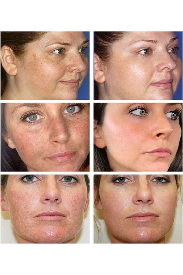 Beyazlatıcı Krem Sabun Ve Serum Seti 3'lü Set - 2