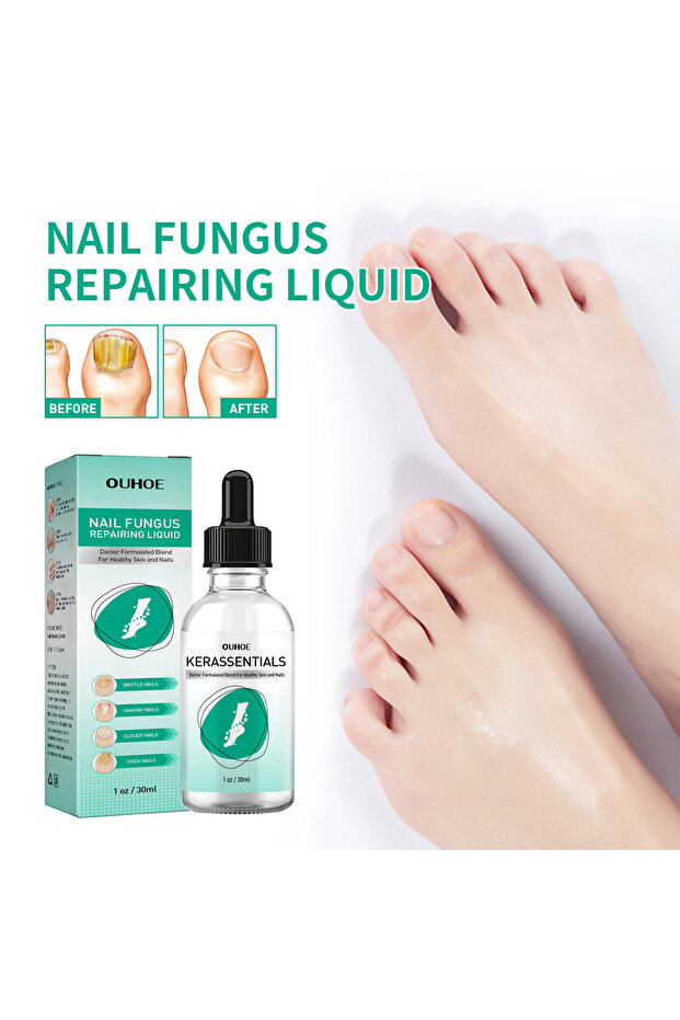 60ml Kerassentials Toenail Fungus Oil Kerasentials Nail Kerassentials Healthy Skin Kerasentials N... - 2