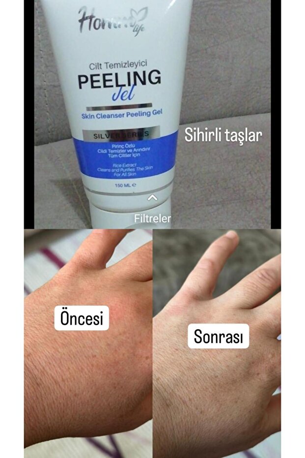 HommBitkisel Peeling Jel - 4