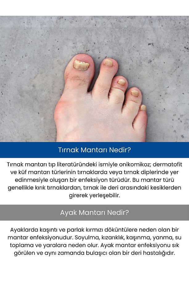 Ayak Ve Tırnak Bakım Spreyi 2 Adet (AVANTAJLI SET) - 2