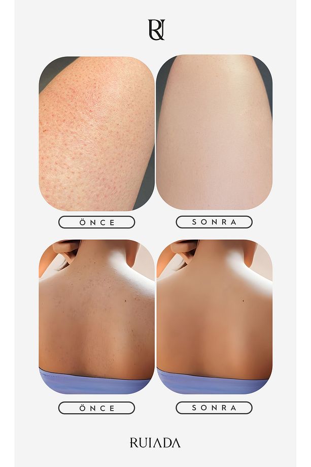 80 Factor Ekru Banyo Duş Kesesi Peeling Eldiveni %100 Floş Ipek Premium Kadın Ve Erkekler Için - 6
