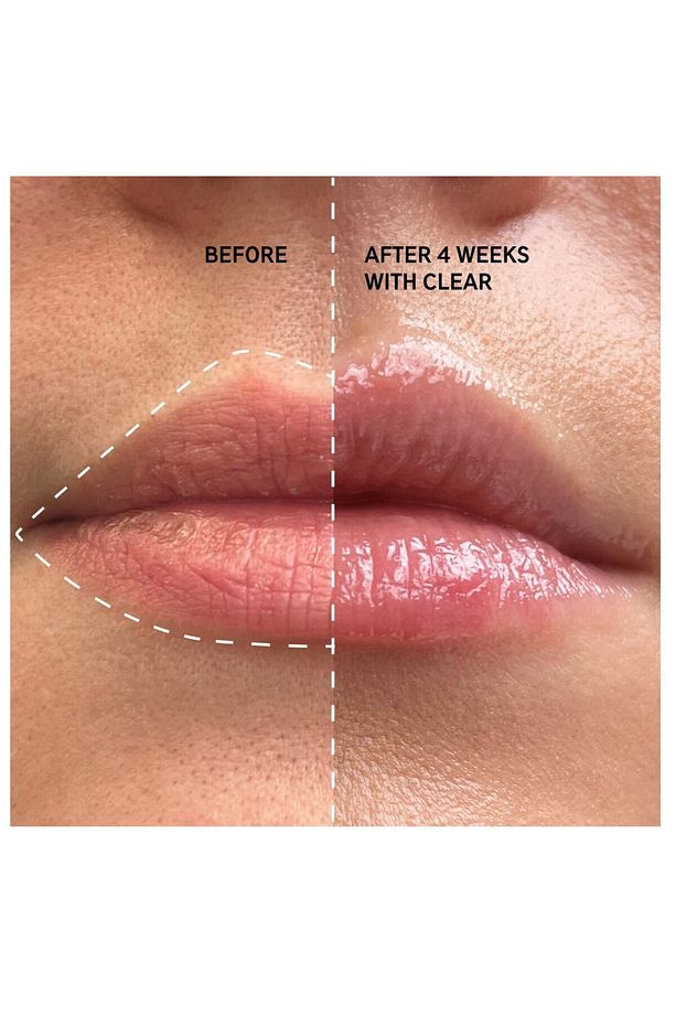 Tripeptide Plumping Lip Balm Berry - Dolgunlaştırıcı Dudak Balmı 10 ml - 4
