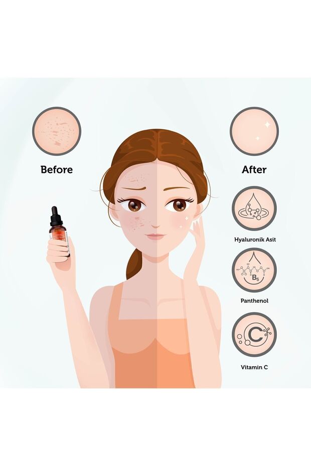 Aydınlatıcı & Cilt Tonu Eşitlemeye Yardımcı Vitamin-C Serum (Hyaluronic Acid+ B5) - 6