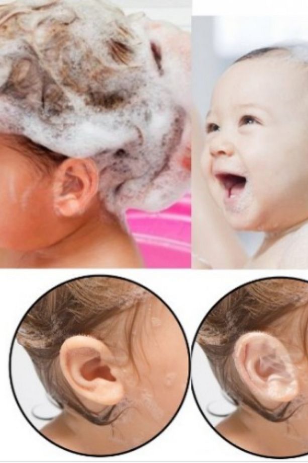 30 Adet Adet Su Geçirmez Bebek Banyo Ve Havuz  Kulak Koruyucu Bant - 4