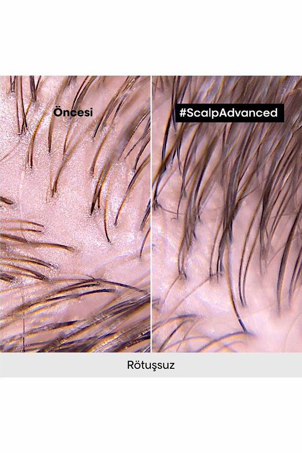 Serie Expert Scalp Advanced Yağlanma Karşıtı Profesyonel Şampuan 500ml - 4