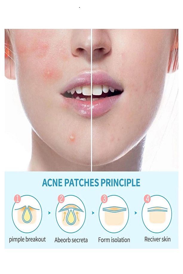 Akne Ve Sivilce Bandı Pimple Patch 36 Patch - 7