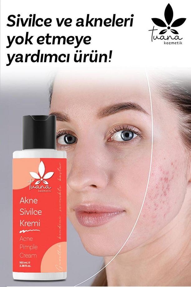 Akne Sivilce Ve Çil Leke Cilt Kremi 100 ML - 4