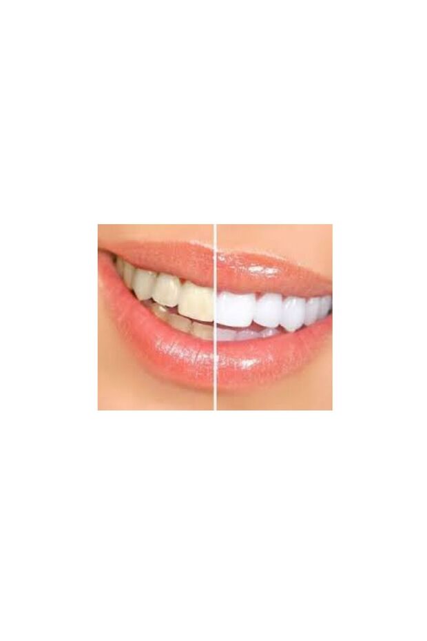 Teeth Whitening Cake 200 Pack - 3
