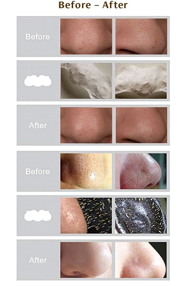 Seul Nose Pack Siyah Nokta ve Gözenek temizleyici Burun Bandı 5 li paket - 9